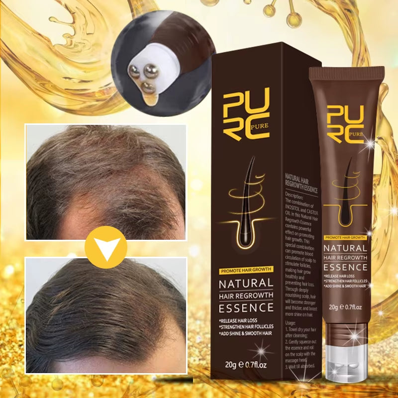 Hair Growth Oil Ginger Essence Fast Growing Hair Products Scalp Treatment Hair Care Set