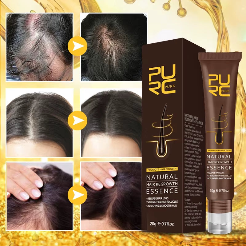 Hair Growth Oil Ginger Essence Fast Growing Hair Products Scalp Treatment Hair Care Set