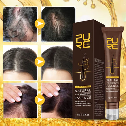 Hair Growth Oil Ginger Essence Fast Growing Hair Products Scalp Treatment Hair Care Set